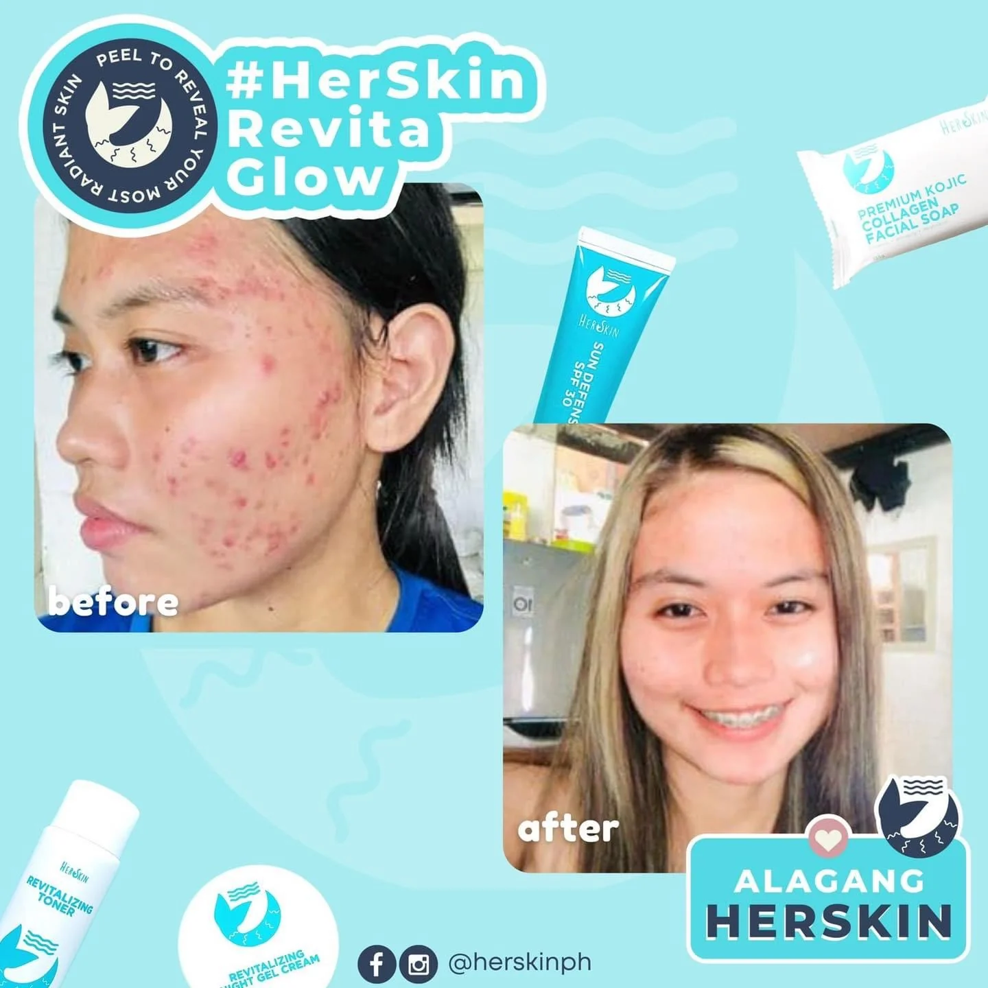 HER SKIN REVITA-GLOW RESCUE KIT - Image 3